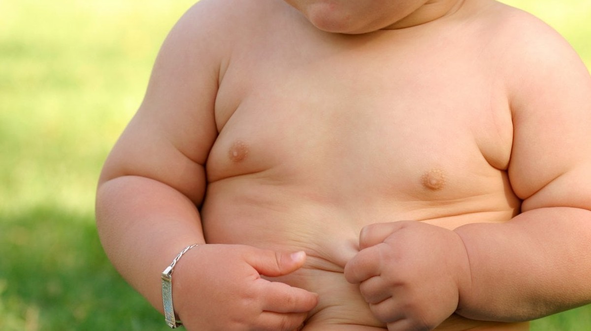 obesita-infantile